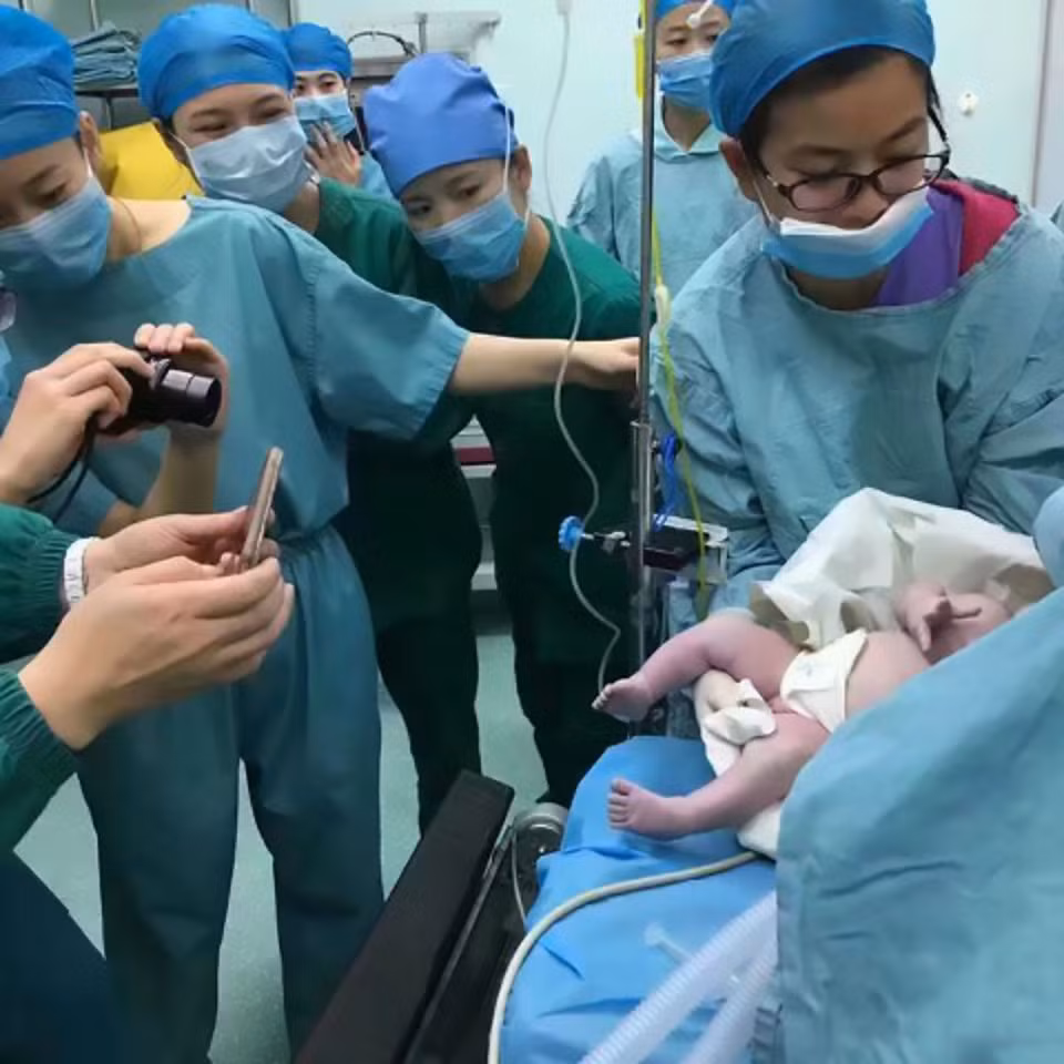 Ảnh chụp trong phòng đẻ cho thấy các bác sĩ và y tá đã phải rất vất vả để ca mổ đẻ thành công. Trong khi bác sĩ cố gắng đỡ sản phụ ngồi dậy để kiểm tra thì các y tá xung quanh gần như phải dùng sức để chống lưng cho bác sĩ khỏi bị bệnh nhân đổ đè vào người. Được biết đây là lần sinh con thứ hai của người phụ nữ này. Hiện sức khỏe của cả hai mẹ con đều tốt. (Nguồn ảnh: The Sun)