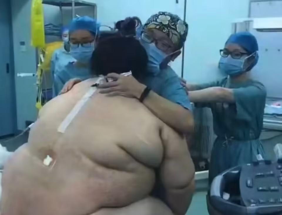 Trọng lượng 140kg đồng nghĩa với việc bà mẹ này phải chịu nhiều biến chứng trong thai kỳ và bác sĩ buộc phải mổ đẻ mới đỡ được bé gái ra ngoài. Ca mổ diễn ra tại bệnh viện Hồ Nam, Trung Quốc.