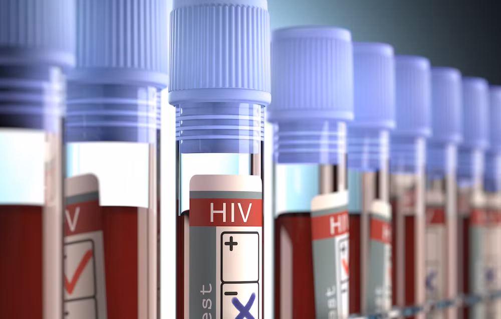 Rúng động sản phụ 9 lần bị chẩn đoán nhầm nhiễm HIV Rung dong san phu 9 lan bi chan doan nham nhiem HIV