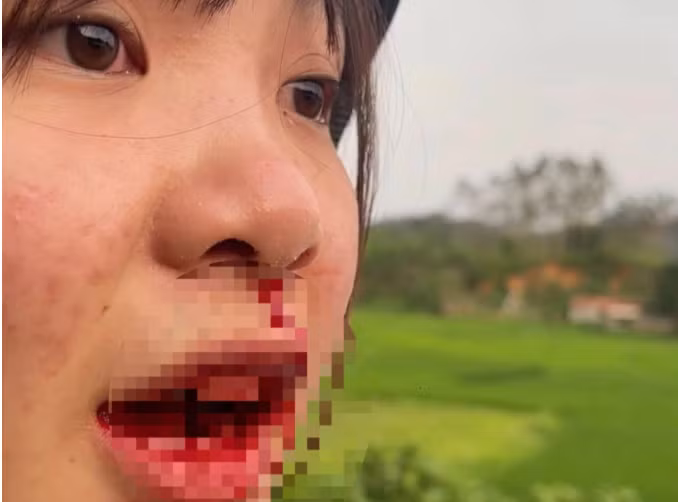 Xac minh tai xe o to hanh hung co gai chay mau o Bac Giang-Hinh-2
