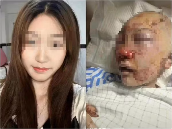 Di ve sinh noi cong cong, co gai gap hoa kinh hoang