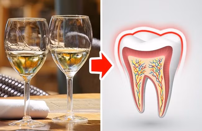 Rượu vang trắng: Rượu có thể làm ố, khiến răng nhạy cảm, dẫn đến hỏng men răng. Rượu cũng có đặc tính khử nước, làm khô miệng, khó tiết nước bọt mà nước bọt lại có tác dụng loại bỏ các tạp chất trong răng.