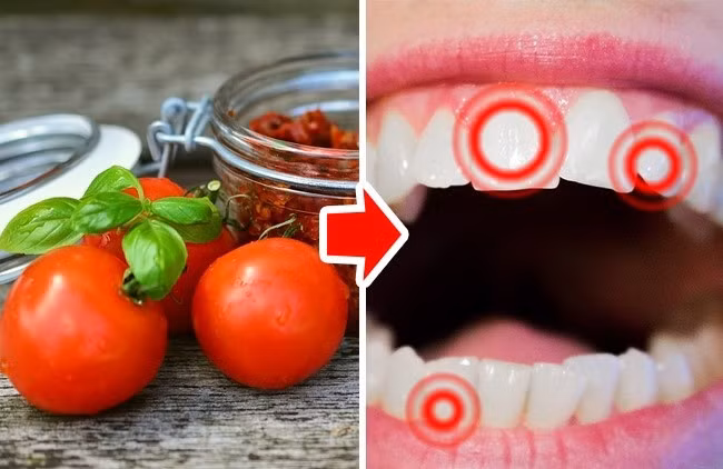 Cà chua: Không chỉ cà chua tươi, các loại nước sốt và nước hầm cà chua đều chứa nhiều axit. Axit rất hại cho răng và làm tăng nguy cơ sâu răng. Cố gắng đừng nấu những món ăn có cà chua quá thường xuyên.
