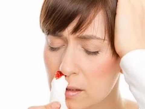 Viêm mũi cấp tính và mạn tính. Viêm mũi làm cho lớp chất nhầy bảo vệ bề mặt niêm mạc mũi bị thương tổn, vì thế các mạch máu nằm ngay dưới đó cũng hay bị xước, rách gây chảy máu mũi.
