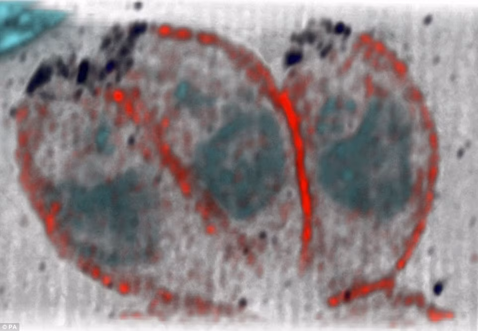 Hình ảnh vi khuẩn Toxoplasmosis - loại ký sinh trùng gây bệnh có trong thịt tái, nấu chưa chín.