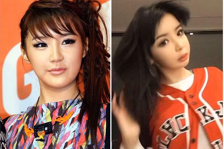 Khó có thể nhận ra Park Bom hiện tại do phẫu thuật thẩm mỹ quá đà.