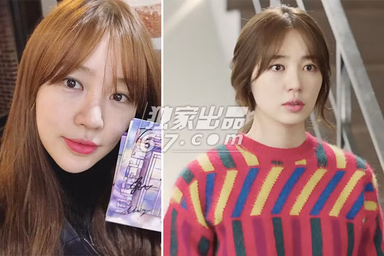 Yoon Eun Hye từng đốn tim fans bởi gương mặt xinh đẹp. Tuy nhiên, những năm gần đây, cô gây thất vọng bởi gương mặt kém tự nhiên, lúc cứng đờ khi sưng phồng.