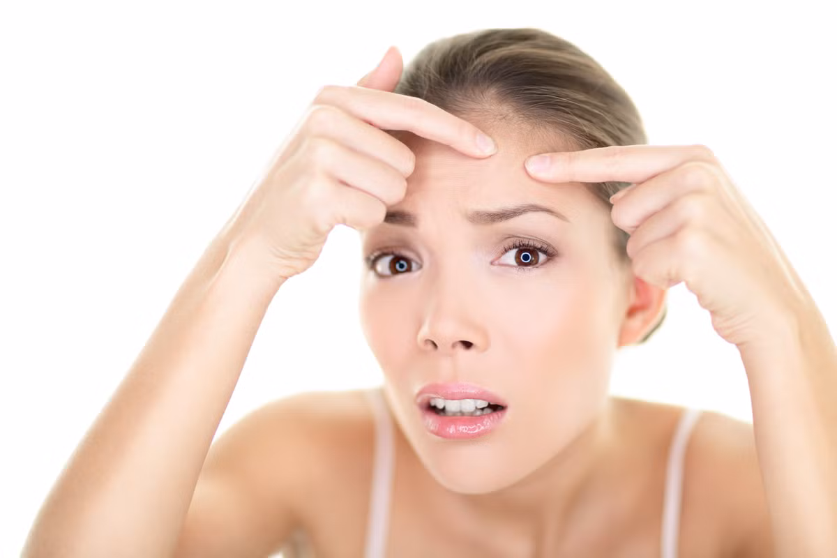 Trị mụn trứng cá và mụn nhọt: Giấm táo có tác dụng loại bỏ chất béo dư thừa trên da, ngăn ngừa nhiễm trùng, điều trị vết thâm và làm thông lỗ chân lông giúp da trở nên thoáng hơn.