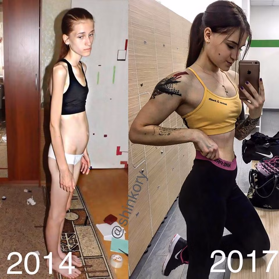 Nữ huấn luyện viên thể dục người Nga Vera Schulz, 18 tuổi, đã có những thay đổi ngoạn mục về ngoại hình và trọng lượng sau khi cô chỉ đạt 33kg vào năm 2014. Ảnh: CEN.