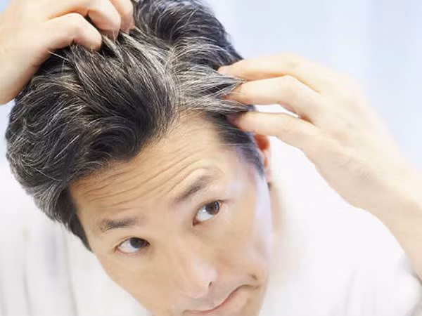 3. Ngăn ngừa tóc trắng: Loại “thần dược” này cũng có tác dụng ngăn ngừa tóc bạc sớm. Không chỉ vậy, lượng vitamin trong dầu neem còn giúp làm giảm nhờn cho da dầu. Ảnh: Boldsky.