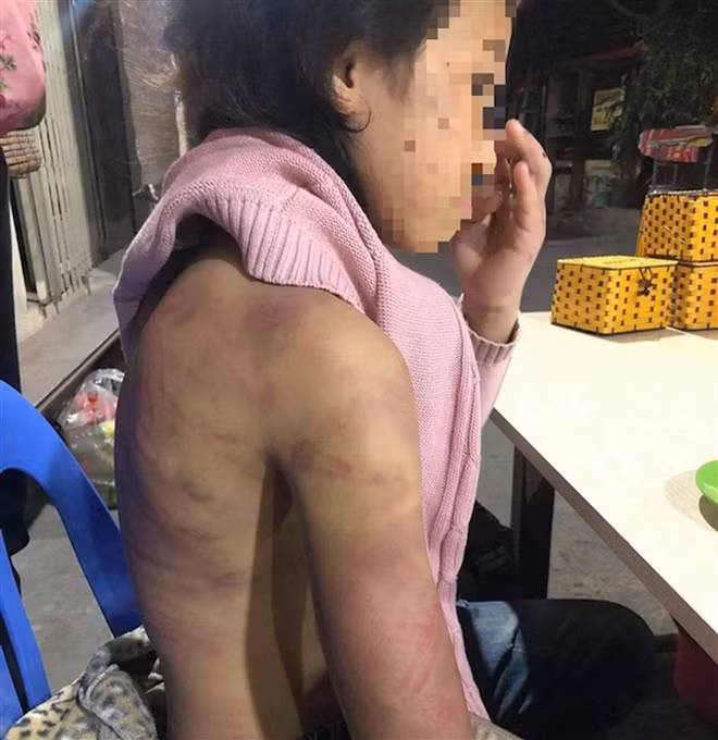 Be gai 12 tuoi nghi bi bao hanh, xam hai tinh duc: Cuc Tre em len tieng