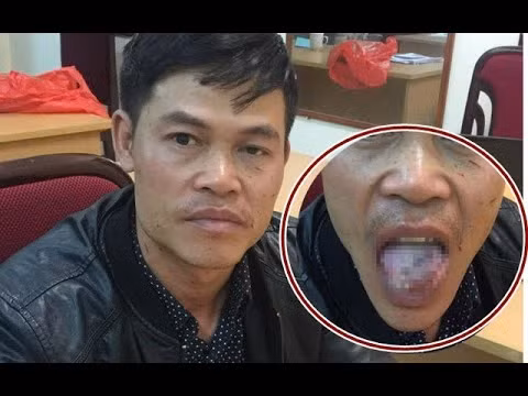 Ngày 12/5, Cơ quan CSĐT Công an huyện Cầu Kè (Trà Vinh) cho biết đang tạm giữ hình sự Sơn Sa Rót (23 tuổi, ngụ xã Phong Thạnh) điều tra về hành vi trộm cắp tài sản và hiếp dâm.