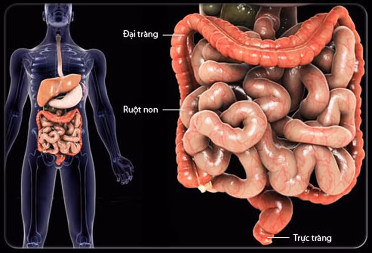  Ung thư trực tràng. Bệnh gặp nhiều ở những nước phát triển và trong những năm gần đây đang có xu hướng tăng mạnh. So với những phương pháp sàng lọc hiện đại, dấu hiệu của bệnh ung thư này rất dễ nhận biết. Nếu bạn bị rối loạn tiêu hóa như tiêu chảy, táo bón không có nguyên nhân cộng với phân có máu, chán ăn sụt cân thì nên đi khám bác sỹ.