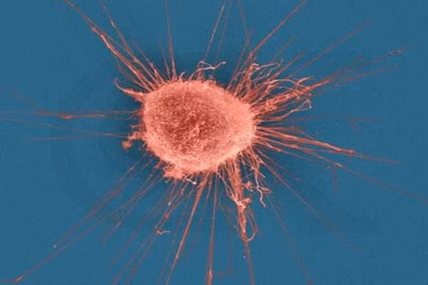 Một nghiên cứu mới được công bố trên Tạp chí Cell Biology, các nhà khoa học cho thấy, một loại protein có tên DENND2B trong các tế bào của cơ thể sẽ làm cho hiện tượng di căn của ung thư nhanh hơn bình thường.