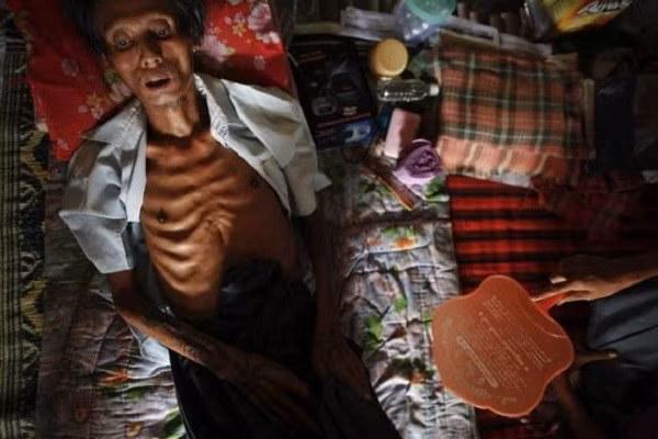  Đại dịch HIV/AIDS: HIV là virus gây hội chứng suy giảm miễn dịch ở người. Nếu không có hệ thống miễn dịch hoạt động tốt, những người bị HIV/AIDS sẽ dễ mắc phải những tổn thương khác, gây nhiễm trùng, dẫn đến tử vong. Virus lây lan qua máu và các chất dịch cơ thể. Hầu hết những người nhiễm virus đều qua quan hệ tình dục hoặc chia sẻ kim tiêm với người mang mầm bệnh. HIV/AIDS khiến 1,5 triệu người tử vong trong số 35 triệu người nhiễm bệnh. Ảnh: Asiasociety