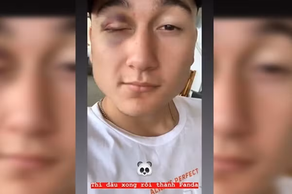 Van Lam khoe mat tham tren mang xa hoi