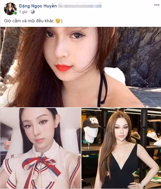 Huyen Baby tu lam phep so sanh nhan sac sau nhieu nam dao keo-Hinh-2