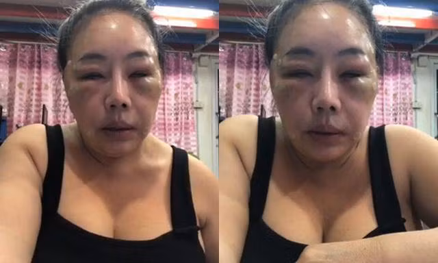 Sự thật về cuộc trùng tu nhan sắc của đại gia 60 tuổi 14 đời chồng Su that ve cuoc trung tu nhan sac cua dai gia 60 tuoi 14 doi chong