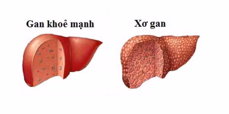 5 tin hieu it ai ngo bao hieu ban can den benh vien ngay