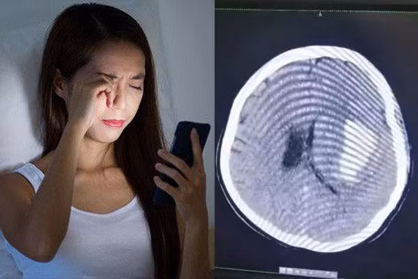Bị chảy máu não, liệt nửa người vì vừa nằm vừa dùng điện thoại Bi chay mau nao, liet nua nguoi vi vua nam vua dung dien thoai