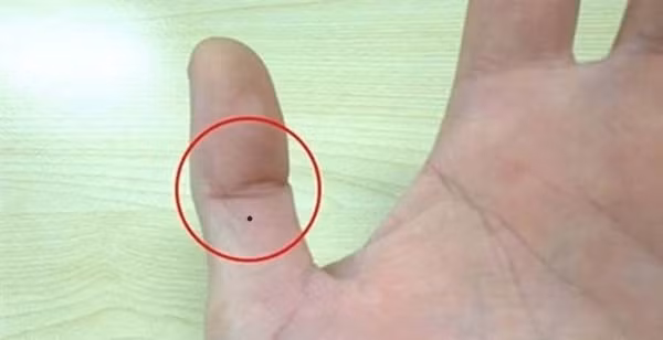 Bên cạnh đó, nếu bạn có nốt ruồi son ở ngón tay cái thì chứng tỏ bạn là người thường xuyên gặp may mắn, được quý nhân phù trợ nên gặp dữ đều hóa lành. Bạn là một người phóng khoáng, không chi li và được nhiều người yêu mến. Nếu có nốt ruồi son trên tay cái đồng thời khoảng cách giữa ngón cái với các ngón còn lại cách xa nhau cho thấy bạn là người tự chủ, dễ thành đạt có thể trở thành ông chủ trong tương lai.