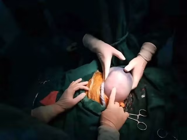 Hy hữu: Bé trai sinh non còn nguyên trong túi ối, nhăn nhó không muốn ra ngoài Hy huu: Be trai sinh non con nguyen trong tui oi, nhan nho khong muon ra ngoai
