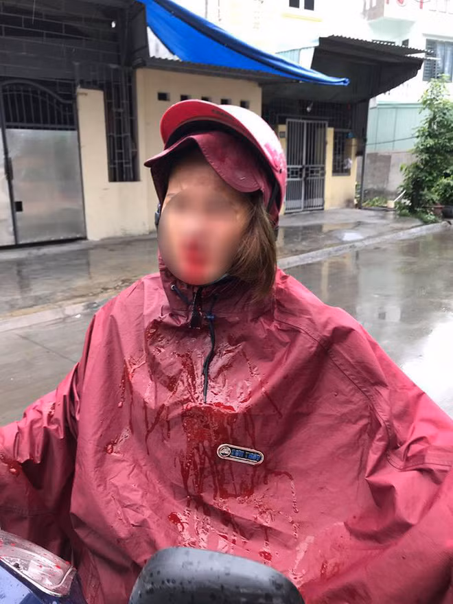 Cay dang vo nuoi chong tu thuo kho khan roi nhan mua don roi