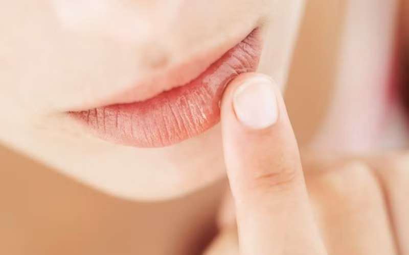 Mất nước: Môi không chứa các tuyến tạo dầu như da của bạn, vì vậy môi có thể bị khô và trở nên nứt nẻ rất dễ dàng. Nếu bạn không uống đủ nước trong ngày, đôi môi của bạn sẽ trở nên khô và bong tróc.