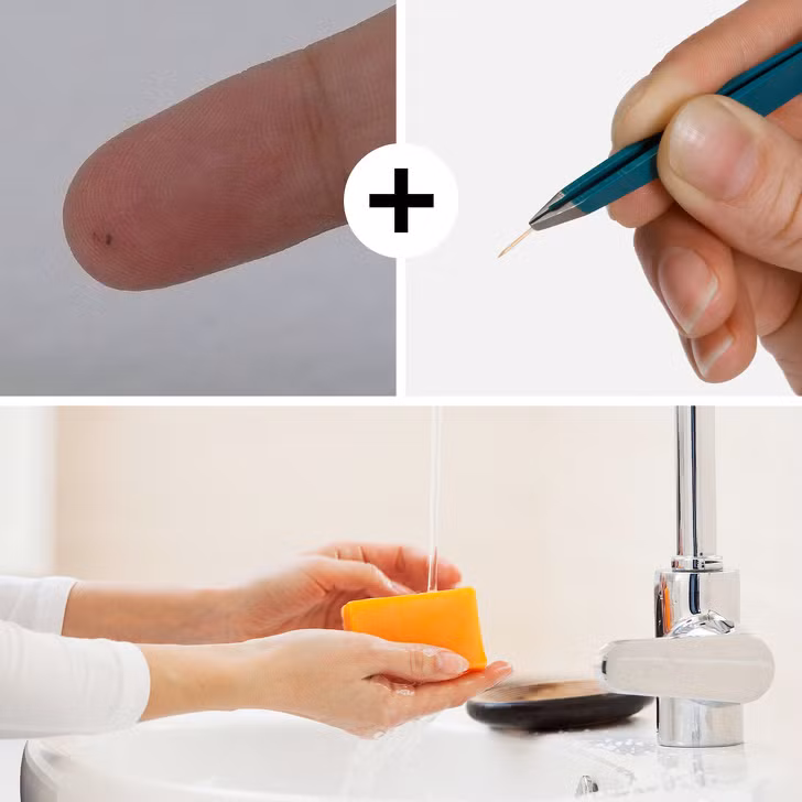 Dằm găm vào da: Dằm (các mảnh gỗ, thủy tinh, nhựa,... nhỏ) chứa đầy vi khuẩn và dễ gây nhiễm trùng trên vết thương hở. Vì vậy, bạn luôn phải sát trùng khi xử lí vết thương. Nếu bạn có một mảnh dằm găm sâu vào da, bạn cần sát trùng vết thương và lấy mảnh dằm ra bằng đầu kim đã được tiệt trùng bằng nước sôi; sau đó rửa sạch bằng xà phòng và nước.