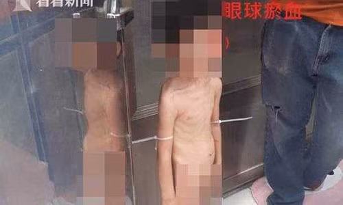 Phan no cau be 3 tuoi bi bo va nguoi tinh bao hanh moi ngay