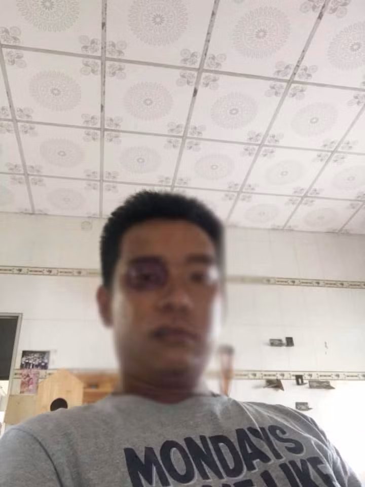 Chong 