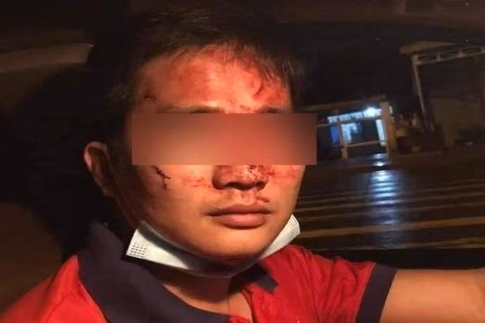 Loi ke cua tai xe taxi bi khach dam tui bui tren xe