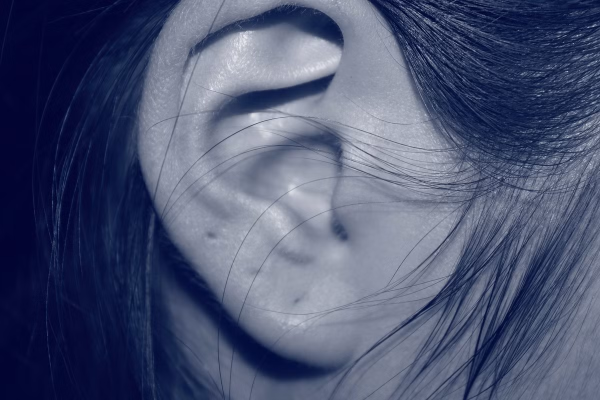 Nghe tiếng lạ trong tai, rùng mình vì "ổ" giòi ký sinh Nghe tieng la trong tai, rung minh vi