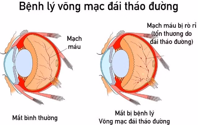 Cách kiểm soát đường huyết trong mùa đông Cach kiem soat duong huyet trong mua dong
