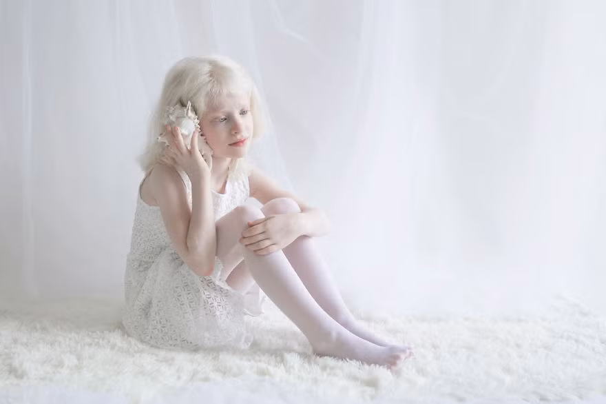 Cô bé Adi thuần khiết như một thiên sứ. (Nguồn Bored Panda)
