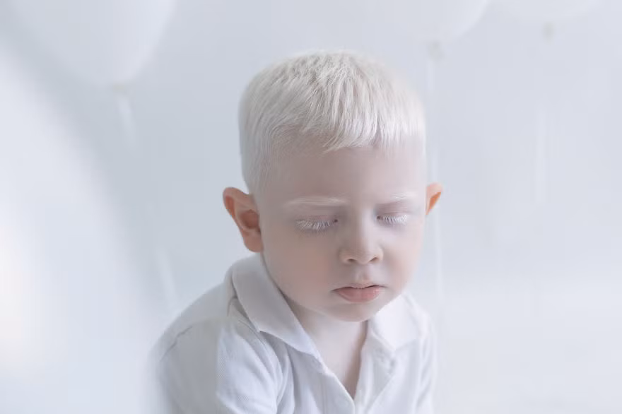 Cậu bé Russell trông giống hệt như một tiểu thiên thần. (Nguồn Bored Panda)