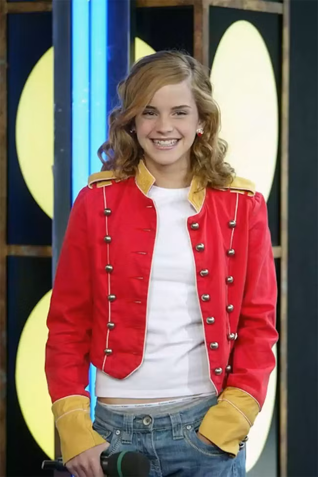 10 lan nguong chin mat cua Emma Watson-Hinh-10