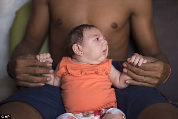 WHO khẳng định virus Zika ăn não người cực kỳ nguy hiểm WHO khang dinh virus Zika an nao nguoi cuc ky nguy hiem
