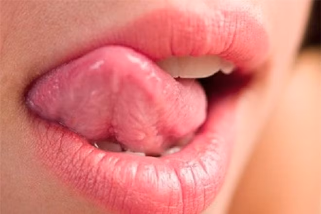 Ngoài ra nếu bỗng nhiên một vùng niêm mạc khoang miệng của bạn trở nên đỏ và gây đau rát, khó lành không rõ nguyên nhân, tình trạng đau ngày càng trầm trọng hơn thì nên tới bệnh viện khám sớm.