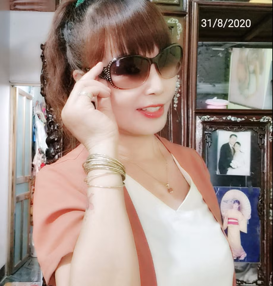 Nhiều người tỏ ra khá hoang mang bởi gương mặt của chị dường như bị hỏng sau lần phẫu thuật căng da mặt vừa qua.