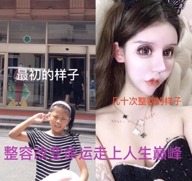 Mới đây, " mẫu nữ mặt rắn" này đã tiết lộ trên trang Weibo rằng mình đã trải qua hơn 100 ca phẫu thuật thẩm mỹ, không phải chỉ dừng lại ở con số 70 lần.