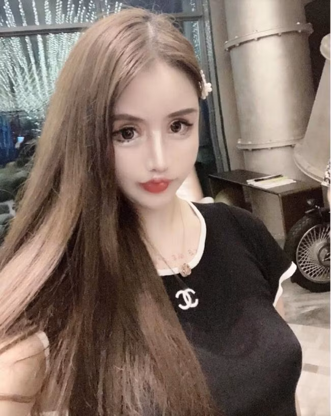 Tiểu Z Nana có niềm đam mê với phẫu thuật thẩm mỹ từ năm 13 tuổi, cô nàng đã tốn khoảng 1 triệu NDT (khoảng 3,43 tỷ đồng) cho những lần phẫu thuật này khi đến năm 15 tuổi.