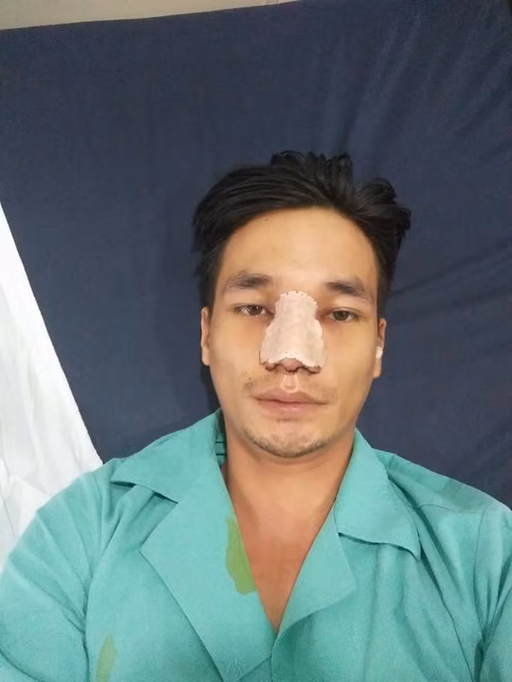 Và khi Lệ Rơi quyết định sửa mũi, công khai những hình ảnh đầu tiên trên bàn phẫu thuật với phần mũi bị băng bó... nhiều người đã đồn đoán, cho rằng nhân vật từng bị xem là "thảm họa mạng" này muốn lột xác để tạo ra sự thay đổi mang tính đột phá trong tương lai. Lận đận với nhiều công việc, cho đến nay Lệ Rơi vẫn chưa thành công với bất kể nghề nghiệp nào nên phải chăng, Lệ Rơi muốn "đập mặt đi xây lại" để tiếp tục được chú ý nhiều hơn, dễ dàng thực hiện những "dự án", công việc hơn.