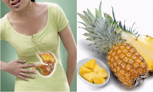 Khi bị đau dày. Quả dứa có nhiều axít hữu cơ và có một số enzyme có tác dụng làm tiêu protein, làm tăng viêm loét niêm mạc dạ dày. Vì vậy, dứa không có lợi cho người đau dạ dày. Ảnh: apexpharma
