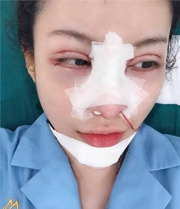 MXH Viet day song voi man lot xac cua gai tre sau tham my-Hinh-2