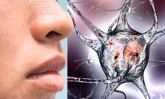 Chú ý dấu hiệu đơn giản này cảnh báo bệnh Parkinson cực kỳ nguy hiểm Chu y dau hieu don gian nay canh bao benh Parkinson cuc ky nguy hiem