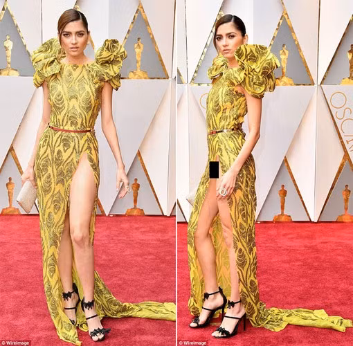 Tại Oscar 2017, cô bị chê vì lộ hàng do chiếc váy xẻ quá cao. Ảnh: WireImage