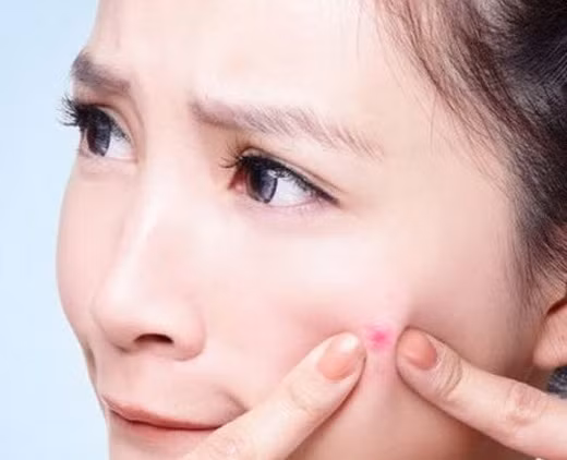 Nổi mụn và phát ban. Khi cơ thể có quá nhiều độc tố, chúng sẽ điều tiết qua da. Thường xuyên bị nổi mụn, phát ban và mắt sưng húp là dấu hiệu cảnh báo cơ thể đang bị “quá tải”.