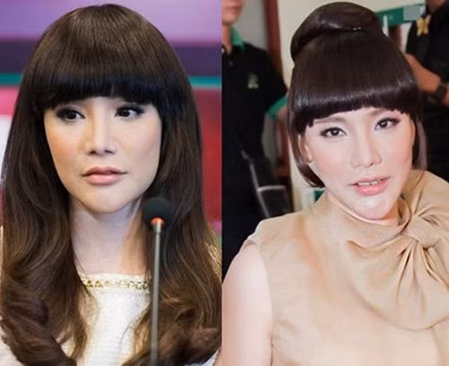 Những chiếc cằm nhọn trông vô lý hết sức của sao Việt Nhũng chiéc càm nhọn trong vo lý hét súc của sao Viẹt
