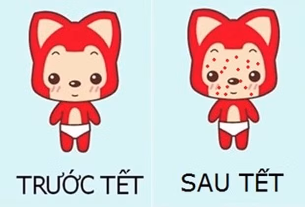 Mụn nổi tưng bừng vì ăn uống vô độ.